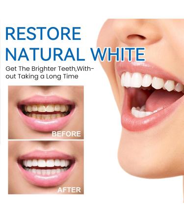 Koahde Blue Toothpaste - Brightening & Whitening for Sensitive Teeth | HA-5 Tooth Care 30ml - Buy Online on GoSupps.com