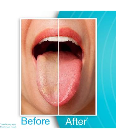 Dr. Tung's Stainless Steel Tongue Cleaner - Pack of 2 - Buy Online on GoSupps.com