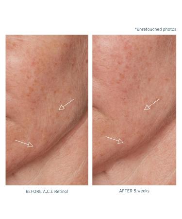 Santo Remedio Piel Eterna Retinol Oil - A.C.E. Rejuvenation with Vitamins A C E & Salicylic Acid for All Skin Types - 1 Fl. Oz - Buy Internationally - Buy Online on GoSupps.com