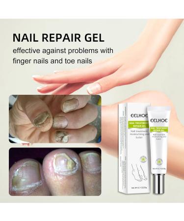 Yueci Hand and Foot Care Cream - Heal & Repair Damaged Nails | Nail Treatment for Cracked & Split Toes - Buy Online on GoSupps.com