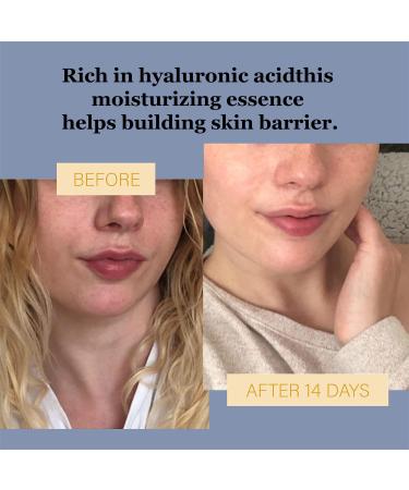 Hyaluronic Acid Essence Spray - Moisturizing & Hydrating Face Mist | Perfect Gift for Girlfriends & Moms | 100ml/3.4oz | BNS - Buy Online on GoSupps.com