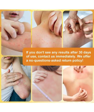 Bee Venom & Manuka Honey Ointment | Natural Relief for Jock Itch Eczema Psoriasis & More | Fast-Acting Moisturizer for Foot & Body - Buy Online on GoSupps.com