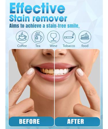 Teeth Whitening Kit for Sensitive Teeth - 35% Carbamide Peroxide Gel LED Light & Dental Trays - Professional Home Oral Care System - Buy Online on GoSupps.com