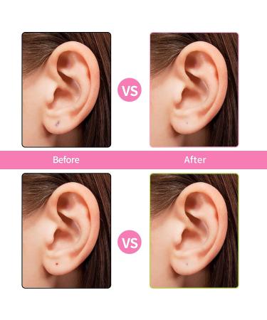 Simarro 360 Pcs Ear Hole Cleaner - Disposable Earring Piercing Cleaning Tool for Odor Removal | Multi-color Care Kit for Women & Men - Buy Online on GoSupps.com