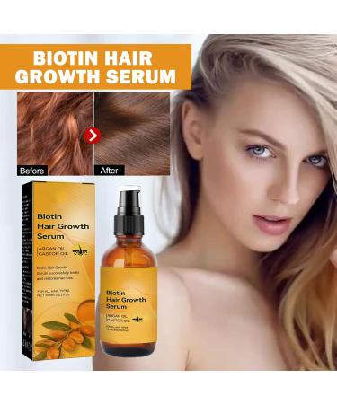 Tongyend Castir Oil Hair Growth Oil Castir Essential Oil Ginger Oil for Hair Growth Rosemary Hair Growth Oil Improve Hair Loss & Nourishes for Women Men-50ML - Buy Online on GoSupps.com