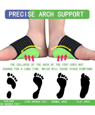 SUBAOQI Plantar Fasciitis Relief Foot Band Support Sleeve - 2 Pair Set for Pain, High Arch, Flat Foot, Heel Spur - Men and Women - Buy Online on GoSupps.com