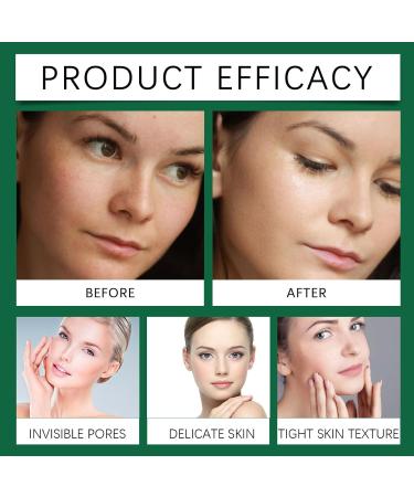 Salicylic Acid Serum - Acne Treatment Oil Control & Pore Shrinkage | Gentle Exfoliating Face Serum for Oily Acne-Prone Skin - 30ml - Buy Online on GoSupps.com