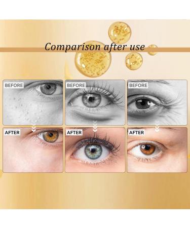 KOAHDE Snail Moisturizing Eye Cream Remove Dark Circles Eye Cream Remove Eye Wrinkles Cream Black Circle Removing Eye Cream Magic Eye Cream Eye Cream Remove Eye Wrinkles Remove Eye Bags Eye Cream 17ML - Buy Online on GoSupps.com