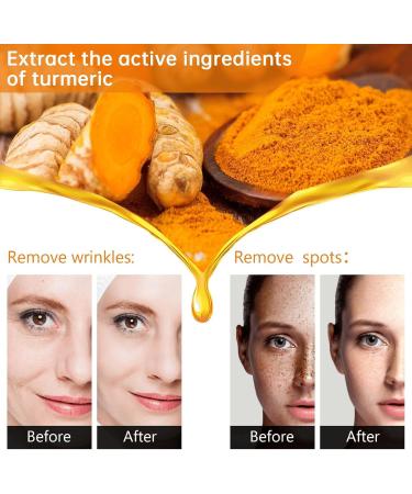 Turmeric Face Serum - Dark Spot Remover for Face - Turmeric Oil Dark Spot Corrector - Impove Dark Spots Moisturizing Erase Fine Lines - Turmeric Serum for Dark Sun Spots - Skin Care Beauty Products - Buy Online on GoSupps.com