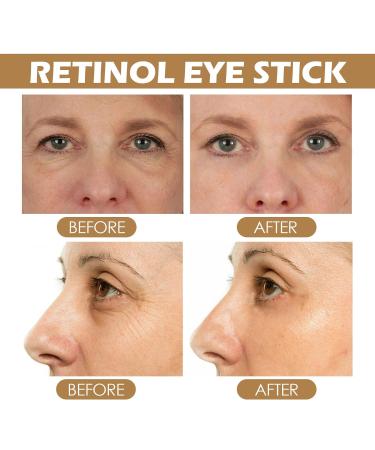 Retinol Eye Cream Stick Lightens Eye Bags Dark Circles Eye Lines Hydrates Moisturizes Firms Eye Area Skin - Buy Online on GoSupps.com