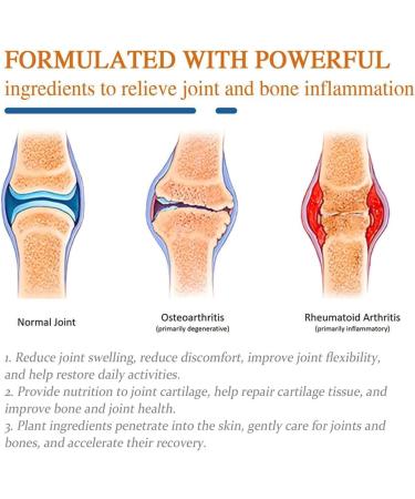 2-Pack Bee Venom Pain Cream | Natural Relief for Arms Waist Legs & More - Fast Shipping Worldwide - Buy Online on GoSupps.com