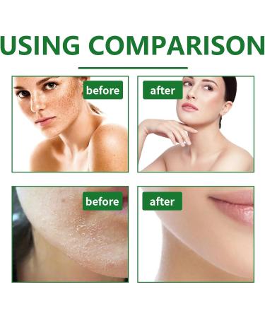 Aloe Vera Facial Scrub - Face Scrub Exfoliator - Aloe Vera Scrub Face Exfoliator - Dark Spot Remover for Face Scrub Gel - Clean Pore Dirt Oil Control - Moisturizing Hydrating Smooth Tender Refreshing - Buy Online on GoSupps.com