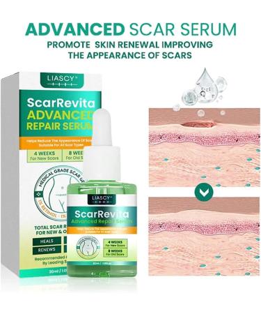 ScarRevita Advanced Repair Serum - Effective Solution for All Types of Scars (3pcs) - Buy Online on GoSupps.com