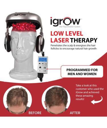 iGrow Laser Hair Growth System - Prevent Hair Loss & Stimulate Growth for Thicker Hair - Men & Women - Buy Online on GoSupps.com