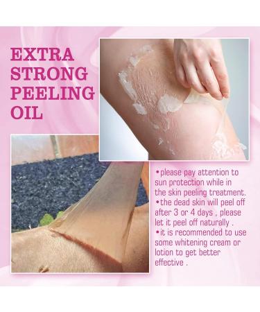 Extra Strong Peeling Oil for Dark Skin | Yellow Exfoliating Solution for Hand & Feet | Chemical Peel for Face | 110ML | Ships Internationally - Buy Online on GoSupps.com