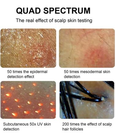 11 Inch Skin Hair Scalp Detector Scalp Hair Follicle Tester Skin Oil Moisture Analyzer Used In Beauty Salons and Hair Care Salons - Buy Online on GoSupps.com