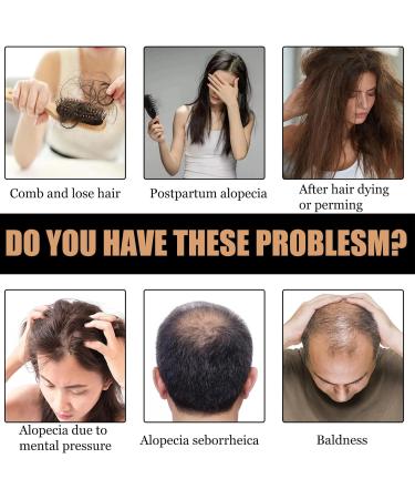 Spartan Root Activator & Hair Thickening Shampoo - Reverse Grey Hair, Reduce Thinning, Promote Hair Regrowth - Men & Women - Darkening Treatment - Buy Online on GoSupps.com