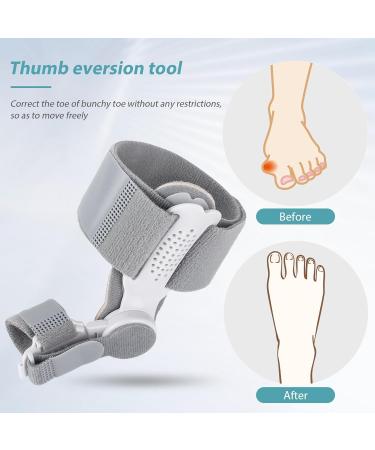 Qoier Bale Toe Correction Spreader - Foot Pain Relief & Orthopedic Solution for Overlapping Toes - Buy Online on GoSupps.com
