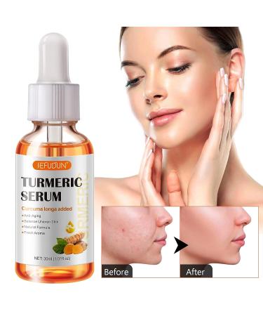 Turmeric Dark Spot Corrector Serum - Acne, Hyperpigmentation, Smooth Skin - Hyaluronic Acid, Vitamin C & E - 1.01 FL.OZ - Buy Online on GoSupps.com