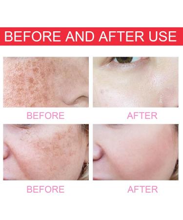  Pemarlis Faded Brightening & Purifying Serum Face Brightening Cream Reduces Discolorations Scars & Spots Brightening Face Cream - Buy Online on GoSupps.com