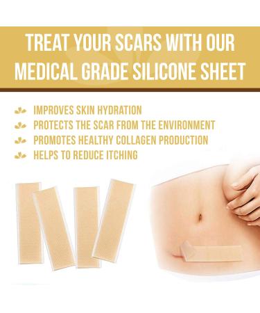HANASCAR Professional Silicone Scar Removal Sheets - Treat C-Section, Burn, Acne & Stretch Mark Scars - Works on Old & New Scars - 5.7 x 1.57 - Buy Online on GoSupps.com