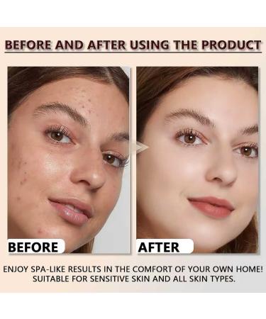 2PCS Rice Exfoliating Ampoule Set Black & White Rice Peel Shot Glow Rice Ampoule Duo Gentle Peel + Pore Minimizing & Deep Hydration for All Skin Types - Buy Online on GoSupps.com