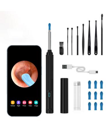 Ear Wax Removal Tool Camera, Wireless Ear Cleaner with 1080P Otoscope & LED Light, Visual Earwax Removal Kit with Soft Silicone Tips, Ear Camera for iOS & Android (Black)