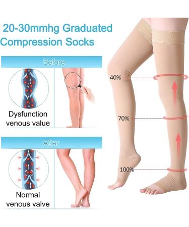 20-30 mmhg Compression Stockings Thigh High - Beige Large (1 Pair) | Open Toe Support Hose for Varicose Veins | Non-Slide Silicone Band - Buy Online on GoSupps.com