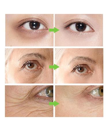 Green Tea Eye Cream - Reduce Dark Circles Puffiness & Wrinkles | Anti-Aging Daily Eye Care 15g - Buy Online on GoSupps.com