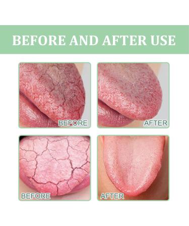 Cracked Tongue Relief Spray - Fresh Breath pH Balance & Odor Elimination - Buy Online on GoSupps.com