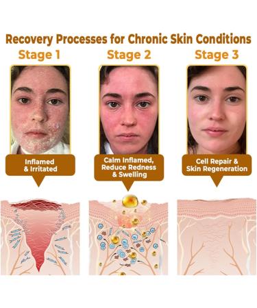  PHFTRCEW VLSVLS Expecting Cremes Experience Huid rearsing & Therapy Cremes VLSVLS Type Cremes Natural Executives Hide Types - Buy Online on GoSupps.com