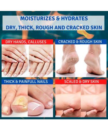 TIS UREA Cream 30% - Treat Eczema Psoriasis & Dry Skin | 2 x 50g | AHA & Wheat Germ Oil | Improve Wounds & Scars - Buy Online on GoSupps.com