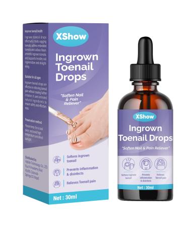 Xshows Ingrown Toenail Treatment  Ingrown Toenail Pain Reliever and Softener for Easy Trimming  30 ml