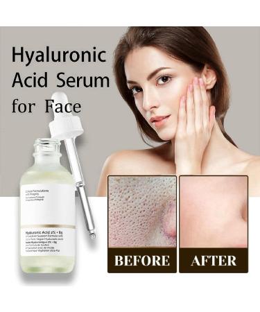 Hyaluronic Acid 2% + B5 Moisturiser Face Hyaluronic Acid for Face Hydrated Face Serum for Women Hyaluronic Acid Serum for Skincare Anti Aging Serum for Face Face Serum for Plump and Smooth Skin - Buy Online on GoSupps.com