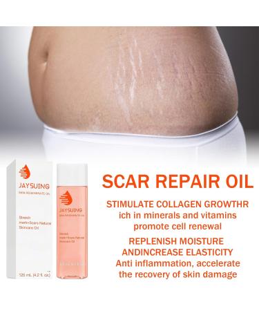 Pregnancy Oil for Stretch Marks - 125ml Massage & Body Oil to Improve Skin Texture & Even Tone - Buy Online on GoSupps.com