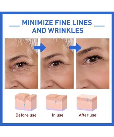 YoungAgain Botox Anti-Aging Serum - Collagen Boost, Dark Spot Corrector, and Wrinkle Defense for All Skin Types - Buy Online on GoSupps.com