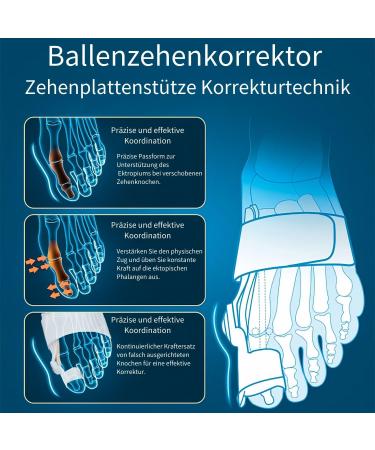 Adjustable Hallux Valgus Correction Rail for Big Toe Straightening - Unisex Day & Night Relief | Comfortable & Effective Solution - Buy Online on GoSupps.com