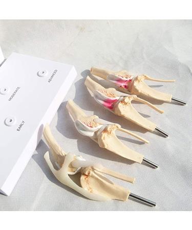4 Stages Dog Knee Model Dog Artificial Knee Joint Model Life Size PVC Dog Knee Joint Model Stages of Canine Osteoporosis Model for Veterinary Office Educational Tool - Buy Online on GoSupps.com