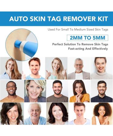 JIAWEIIY 2-in-1 Auto Skin T_ag Removal Kit for Skin T_ag (2-8mm) Skin T_ag Remover Device for Skin T_ags Fast and Easy Skin T_ag Remover Pen Device - Buy Online on GoSupps.com