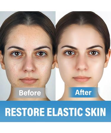 10% Tranexam c Acid Serum D scolorat on Correcting Serum Natural Spot Remover for Face with Hyaluronic Acid & Niacinamide 50 ML - Buy Online on GoSupps.com