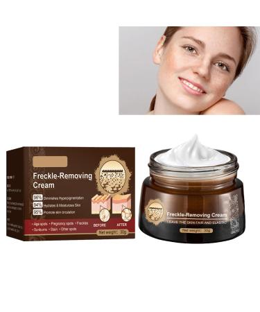 KOAHDE Freckle Removal Cream For Face Freckle Cream Anti Melasma Facial Moisturize Cream Moisturizing Anti-Blemish Cream Pigmentation Removal Cream for Face Skin Brightening Cream Dark Spot Corrector