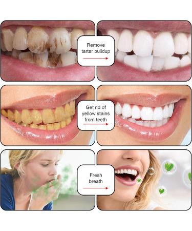 Probiotic Whitening Toothpaste Sp-7 Ultra Probiotic Whitening Toothpaste Sp-6 Anti-Stain Toothpaste Whitening Teeth Sp-6 3-Piece Set Probiotic Whitening Agent - Buy Online on GoSupps.com