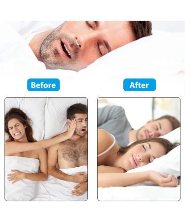 8pcs Magnetic Anti Snoring Devices - Nasal Dilator Clips for Men and Women | Stop Snoring Aid for Better Breathing and Comfortable Sleep - Buy Online on GoSupps.com