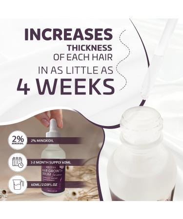 Belleka Minoxidil for Women 2% Hair Growth Serum - Thinning Hair Treatment - Regrow, Strengthen, and Thicken Hair - Stop Hair Loss - 60ml - Buy Online on GoSupps.com