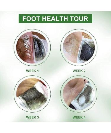 10PCS Detox Foot Pads Natural Slimming Patch Loss Weight Body Toxins Relief Stress Improve Sleep - Buy Online on GoSupps.com
