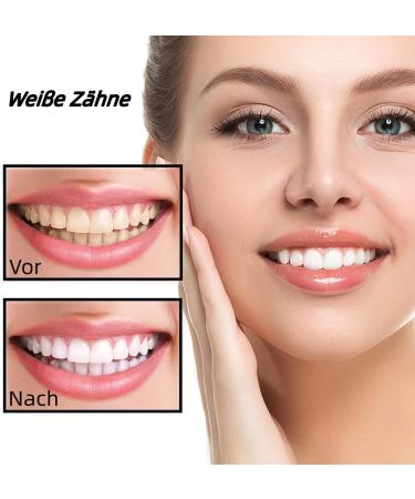 MELARQT White Stripes Teeth Whitening Strips - Professional Stain Removal for Brighter Smile at Home (28 Pieces) - Buy Online on GoSupps.com