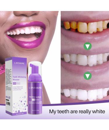 Teeth Whitening Mousse V34 - Brighten Your Smile | International Shipping Available - Buy Online on GoSupps.com