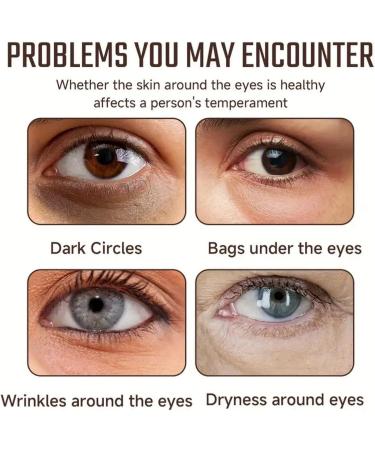 Multi-Peptide Eye Serum Eye Cream for Dark Circles and Puffy Eyes Under Eye Serum Anti Aging Eye Bags Remover Eye Cream for Wrinkles Firming Eye Cream Instant Wrinkle Remover Eye Gel Eye Bag Cream - Buy Online on GoSupps.com