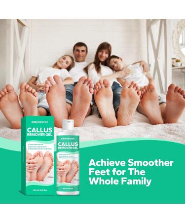 Extra Strength Callus Remover Gel for Feet - 8.45 fl.oz Powerful Foot Care Solution Home Use Calloused Feet Remover - Buy Online on GoSupps.com