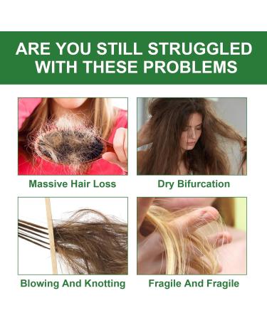 Rosemary Oil for Hair Growth Anti Hair Loss Hair Serum Rosemary Essential Oil With Peppermint Oil Coconut Oil And Castor Oil Extracts Hair Growth Oil for Women & Men 30ml - Buy Online on GoSupps.com